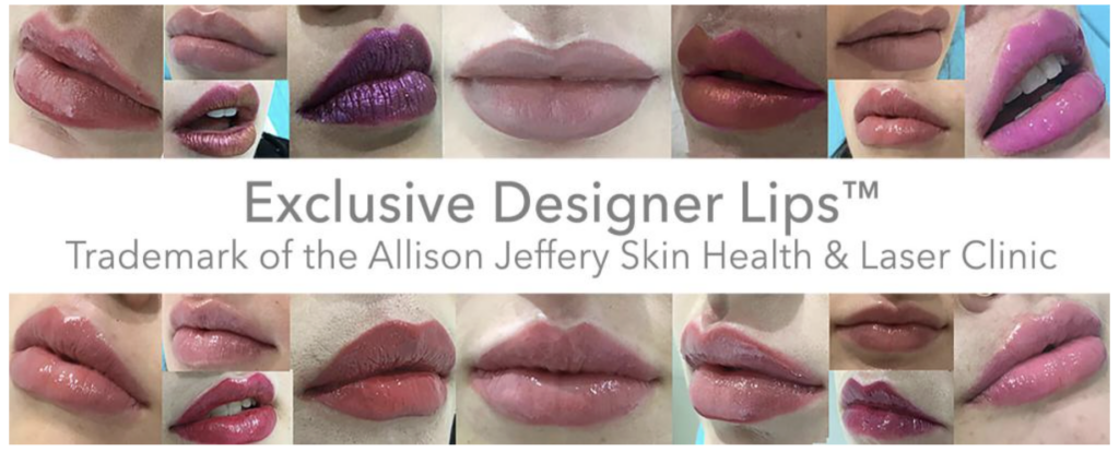 IAAFA Lip Sculpting Award recipients with precision lip sculpting techniques
